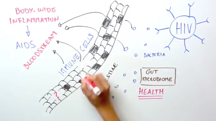 A Gut Reaction to HIV A Gut Reaction to HIV