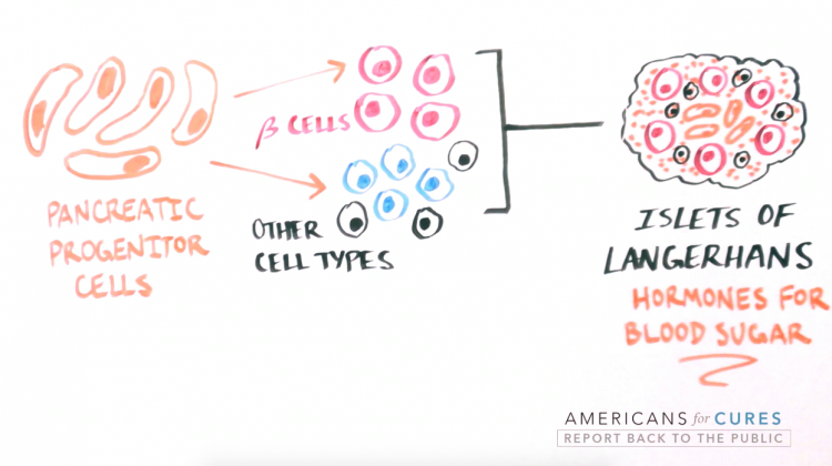Progress and Promise of Stem Cell Research: Type 1 Diabetes Progress and Promise of Stem Cell Research: Type 1 Diabetes